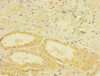 Immunohistochemistry of paraffin-embedded human kidney tissue using CSB-PA023453ESR1HU at dilution of 1:100