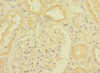 Immunohistochemistry of paraffin-embedded human kidney tissue using CSB-PA023453ESR2HU at dilution of 1:100