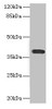 Western blot<br />
 All lanes: CD226 antibody at 2.61µg/ml + A549 whole cell lysate<br />
 Secondary<br />
 Goat polyclonal to rabbit IgG at 1/10000 dilution<br />
 Predicted band size: 39 kDa<br />
 Observed band size: 39 kDa<br />