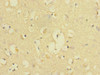 Immunohistochemistry of paraffin-embedded human brain tissue using CSB-PA618996ESR2HU at dilution of 1:100