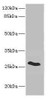 Western blot<br />
 All lanes: CLDN18 antibody IgG at 5.02µg/ml + Rat heart tissue<br />
 Secondary<br />
 Goat polyclonal to rabbit IgG at 1/10000 dilution<br />
 Predicted band size: 28 kDa<br />
 Observed band size: 28 kDa<br />