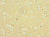 Immunohistochemistry of paraffin-embedded human brain tissue using CSB-PA892475ESR2HU at dilution of 1:100