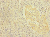 Immunohistochemistry of paraffin-embedded human pancreatic tissue using CSB-PA850397ESR2HU at dilution of 1:100