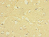 Immunohistochemistry of paraffin-embedded human brain tissue using CSB-PA850317ESR1HU at dilution of 1:100