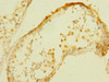 Immunohistochemistry of paraffin-embedded human testis tissue using CSB-PA889164ESR1HU at dilution of 1:100
