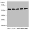 Western blot<br />
 All lanes: MPP6 antibody at 3.58µg/ml<br />
 Lane 1: Mouse brain tissue<br />
 Lane 2: Mouse kidney tissue<br />
 Lane 3: HepG2 whole cell lysate<br />
 Lane 4: Hela whole cell lysate<br />
 Lane 5: A549 whole cell lysate<br />
 Secondary<br />
 Goat polyclonal to rabbit IgG at 1/10000 dilution<br />
 Predicted band size: 61 kDa<br />
 Observed band size: 61 kDa<br />