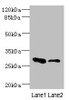 Western blot<br />
 All lanes: EAF2 antibody at 3.6µg/ml<br />
 Lane 1: Rat heart tissue<br />
 Lane 2: Mouse kidney tissue<br />
 Secondary<br />
 Goat polyclonal to rabbit IgG at 1/10000 dilution<br />
 Predicted band size: 29, 15 kDa<br />
 Observed band size: 29 kDa<br />