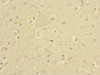 Immunohistochemistry of paraffin-embedded human brain tissue using CSB-PA856910DSR1HU at dilution of 1:100