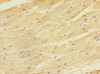 Immunohistochemistry of paraffin-embedded human heart tissue using CSB-PA856910DSR1HU at dilution of 1:100