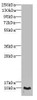 Western blot<br />
 All lanes: CRIP1 antibody at 1.44µg/ml + PC-3 whole cell lysate<br />
 Secondary<br />
 Goat polyclonal to rabbit IgG at 1/10000 dilution<br />
 Predicted band size: 9 kDa<br />
 Observed band size: 9 kDa<br />