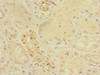 Immunohistochemistry of paraffin-embedded human kidney tissue using CSB-PA005969DSR1HU at dilution of 1:100