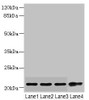 Western blot<br />
 All lanes: CSRP2 antibody at 5.74µg/ml<br />
 Lane 1: Mouse lung tissue<br />
 Lane 2: A375 whole cell lysate<br />
 Lane 3: A549 whole cell lysate<br />
 Lane 4: HepG2 whole cell lysate<br />
 Secondary<br />
 Goat polyclonal to rabbit IgG at 1/10000 dilution<br />
 Predicted band size: 21 kDa<br />
 Observed band size: 21 kDa<br />