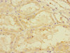 Immunohistochemistry of paraffin-embedded human kidney tissue using CSB-PA716571ESR1HU at dilution of 1:100