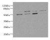 Western blot<br />
 All lanes: LDB3 antibody at 3.21ug/ml<br />
 Lane 1 : Hela whole cell lysate<br />
 Lane 2 : Raji whole cell lysate<br />
 Lane 3 : MCF-7 whole cell lysate<br />
 Lane 4 : A431 whole cell lysate<br />
 Secondary<br />
 Goat polyclonal to rabbit IgG at 1/10000 dilution<br />
 Predicted band size: 78, 67, 51, 43, 36, 31, 79 kDa<br />
 Observed band size: 67, 51 kDa<br />