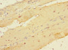 Immunohistochemistry of paraffin-embedded human skeletal muscle tissue using CSB-PA012831ESR2HU at dilution of 1:100