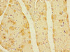 Immunohistochemistry of paraffin-embedded human heart tissue using CSB-PA012831ESR2HU at dilution of 1:100