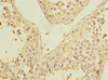 Immunohistochemistry of paraffin-embedded human testis tissue using CSB-PA017835ESR1HU at dilution of 1:100