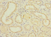 Immunohistochemistry of paraffin-embedded human kidney tissue using CSB-PA017835ESR1HU at dilution of 1:100