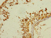 Immunohistochemistry of paraffin-embedded human testis tissue using CSB-PA767207ESR1HU at dilution of 1:100