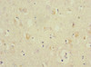 Immunohistochemistry of paraffin-embedded human brain tissue using CSB-PA767207ESR1HU at dilution of 1:100