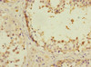 Immunohistochemistry of paraffin-embedded human testis tissue using CSB-PA767207ESR2HU at dilution of 1:100