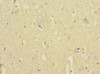 Immunohistochemistry of paraffin-embedded human brain tissue using CSB-PA767207ESR2HU at dilution of 1:100
