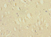 Immunohistochemistry of paraffin-embedded human brain tissue using CSB-PA004421ESR1HU at dilution of 1:100