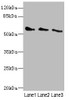 Western blot<br />
 All lanes: CHRNG antibody at 5.5µg/ml<br />
 Lane 1: 293T whole cell lysate<br />
 Lane 2: HepG2 whole cell lysate<br />
 Lane 3: Hela whole cell lysate<br />
 Secondary<br />
 Goat polyclonal to rabbit IgG at 1/10000 dilution<br />
 Predicted band size: 58, 53 kDa<br />
 Observed band size: 58 kDa<br />