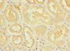 Immunohistochemistry of paraffin-embedded human kidney tissue using CSB-PA897321ESR1HU at dilution of 1:100