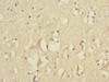 Immunohistochemistry of paraffin-embedded human brain tissue using CSB-PA008618ESR1HU at dilution of 1:100