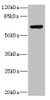 Western blot<br />
 All lanes: SLC13A2 antibody at 1.29µg/ml + 293T whole cell lysate<br />
 Secondary<br />
 Goat polyclonal to rabbit IgG at 1/10000 dilution<br />
 Predicted band size: 65, 70 kDa<br />
 Observed band size: 65 kDa<br />