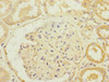Immunohistochemistry of paraffin-embedded human kidney tissue using CSB-PA618762ESR1HU at dilution of 1:100