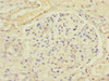 Immunohistochemistry of paraffin-embedded human kidney tissue using CSB-PA618762ESR2HU at dilution of 1:100