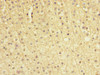 Immunohistochemistry of paraffin-embedded human adrenal gland tissue using CSB-PA022394ESR1HU at dilution of 1:100