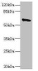 Western blot<br />
 All lanes: SOCS5 antibody IgG at 1.83µg/ml + 293T whole cell lysate<br />
 Secondary<br />
 Goat polyclonal to rabbit IgG at 1/10000 dilution<br />
 Predicted band size: 61 kDa<br />
 Observed band size: 61 kDa<br />