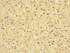Immunohistochemistry of paraffin-embedded human adrenal gland tissue using CSB-PA022394ESR2HU at dilution of 1:100