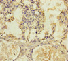 Immunohistochemistry of paraffin-embedded human lung tissue using CSB-PA644808ESR1HU at dilution of 1:100