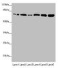 Western blot<br />
 All lanes: KIZ antibody at 2.89µg/ml<br />
 Lane 1: HepG2 whole cell lysate<br />
 Lane 2: A549 whole cell lysate<br />
 Lane 3: CEM whole cell lysate<br />
 Lane 4: Hela whole cell lysate<br />
 Lane 5: Jurkat whole cell lysate<br />
 Lane 6: 293T whole cell lysate<br />
 Secondary<br />
 Goat polyclonal to rabbit IgG at 1/10000 dilution<br />
 Predicted band size: 76, 63, 70, 74, 60 kDa<br />
 Observed band size: 76 kDa<br />