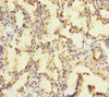 Immunohistochemistry of paraffin-embedded human lung tissue using CSB-PA644808ESR2HU at dilution of 1:100