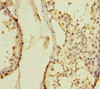 Immunohistochemistry of paraffin-embedded human testis tissue using CSB-PA644808ESR2HU at dilution of 1:100