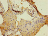 Immunohistochemistry of paraffin-embedded human testis tissue using CSB-PA007228ESR2HU at dilution of 1:100