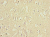 Immunohistochemistry of paraffin-embedded human brain tissue using CSB-PA007729ESR2HU at dilution of 1:100