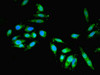 Immunofluorescent analysis of Hela cells using CSB-PA846077ESR1HU at dilution of 1:100 and Alexa Fluor 488-congugated AffiniPure Goat Anti-Rabbit IgG (H+L)