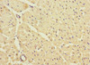 Immunohistochemistry of paraffin-embedded human heart tissue using CSB-PA012057ESR1HU at dilution of 1:100