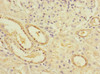 Immunohistochemistry of paraffin-embedded human kidney tissue using CSB-PA614805ESR1HU at dilution of 1:100