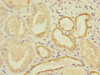 Immunohistochemistry of paraffin-embedded human kidney tissue using CSB-PA015263ESR1HU at dilution of 1:100