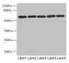 Western blot<br />
 All lanes: ARHGEF3 antibody at 2.21µg/ml<br />
 Lane 1: MCF-7 whole cell lysate<br />
 Lane 2: HepG2 whole cell lysate<br />
 Lane 3: Jurkat whole cell lysate<br />
 Lane 4: Hela whole cell lysate<br />
 Lane 5: 293T whole cell lysate<br />
 Secondary<br />
 Goat polyclonal to rabbit IgG at 1/10000 dilution<br />
 Predicted band size: 60, 64, 61, 37 kDa<br />
 Observed band size: 60 kDa<br />