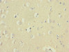 Immunohistochemistry of paraffin-embedded human brain tissue using CSB-PA850248ESR1HU at dilution of 1:100
