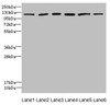 Western blot<br />
 All lanes: UBE4A antibody at 2.24µg/ml<br />
 Lane 1: K562 whole cell lysate<br />
 Lane 2: MCF-7 whole cell lysate<br />
 Lane 3: Jurkat whole cell lysate<br />
 Lane 4: Caco-2 whole cell lysate<br />
 Lane 5: HepG2 whole cell lysate<br />
 Lane 6: 293T whole cell lysate<br />
 Secondary<br />
 Goat polyclonal to rabbit IgG at 1/10000 dilution<br />
 Predicted band size: 123, 124 kDa<br />
 Observed band size: 123 kDa<br />