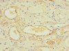 Immunohistochemistry of paraffin-embedded human kidney tissue using CSB-PA619860ESR1HU at dilution of 1:100
